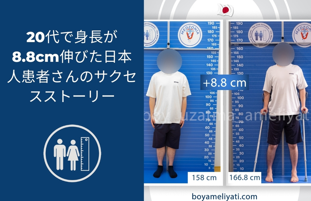 20代で身長が8.8cm伸びた日本人患者さんのサクセスストーリー